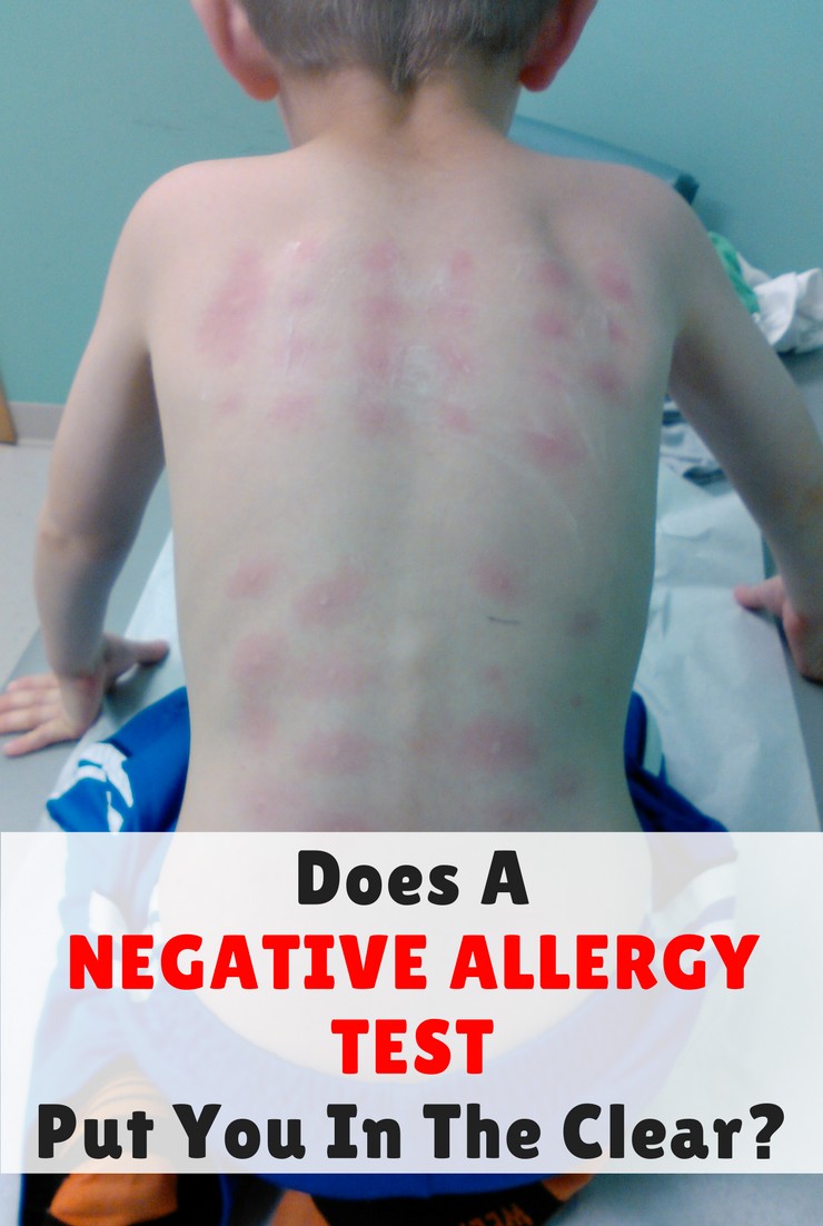 Does A Negative Allergy Test Put You In The Clear Simple Steps To Move Forward